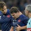 France rugby captain Dupont suffers facial fracture