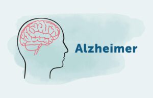 Breakthrough Approval: Australia Welcomes First Drug for Early-Stage Alzheimer’s!