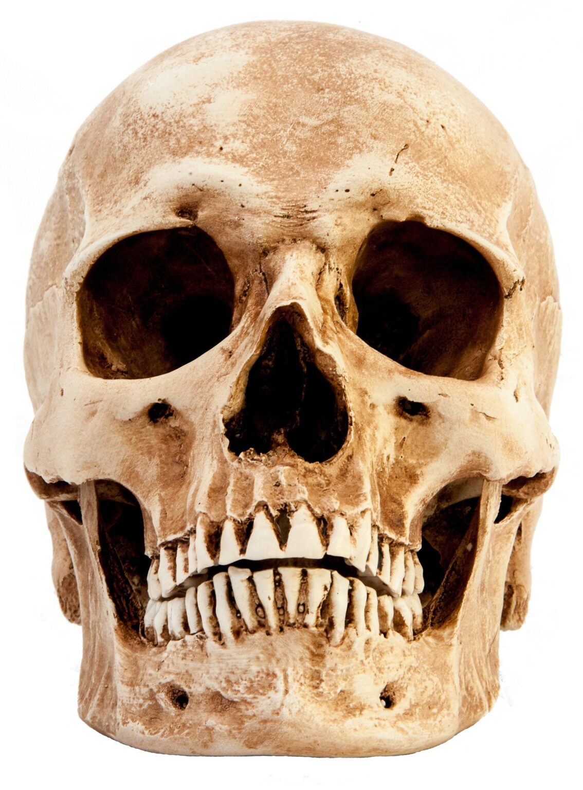 Ancient Argentine Skull Reveals Intriguing Pre-Columbian Head-Shaping Secrets