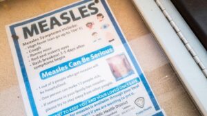 Is Canada Losing Measles Elimination Status-and Is the U.S. Next?